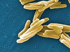 The Mycobacterium tuberculosis bacteria is shown