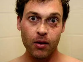 STUNNED: Toronto rich kid Blake Leibel poses for his mugshot not long after torturing and murdering his girlfriend. LA COUNTY SHERIFF