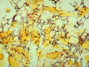 A photomicrograph shows the presence of Treponema pallidum spirochetes, the causative agent of syphilis, in a tissue sample taken from an infected rabbit.