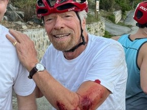 Richard Branson displays his injuries on Instagram