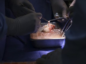 Pig Kidney Transplant
