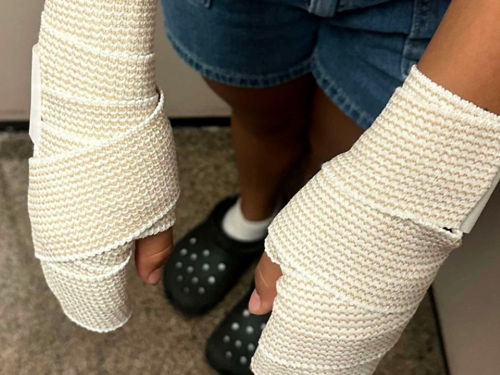 Texas middle school cheerleaders suffer severe burns after ‘malicious’ punishment