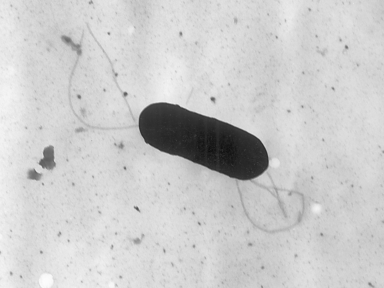 DEADLY PASTA: Listeria Kills 6 – Is Your Dinner a Risk?