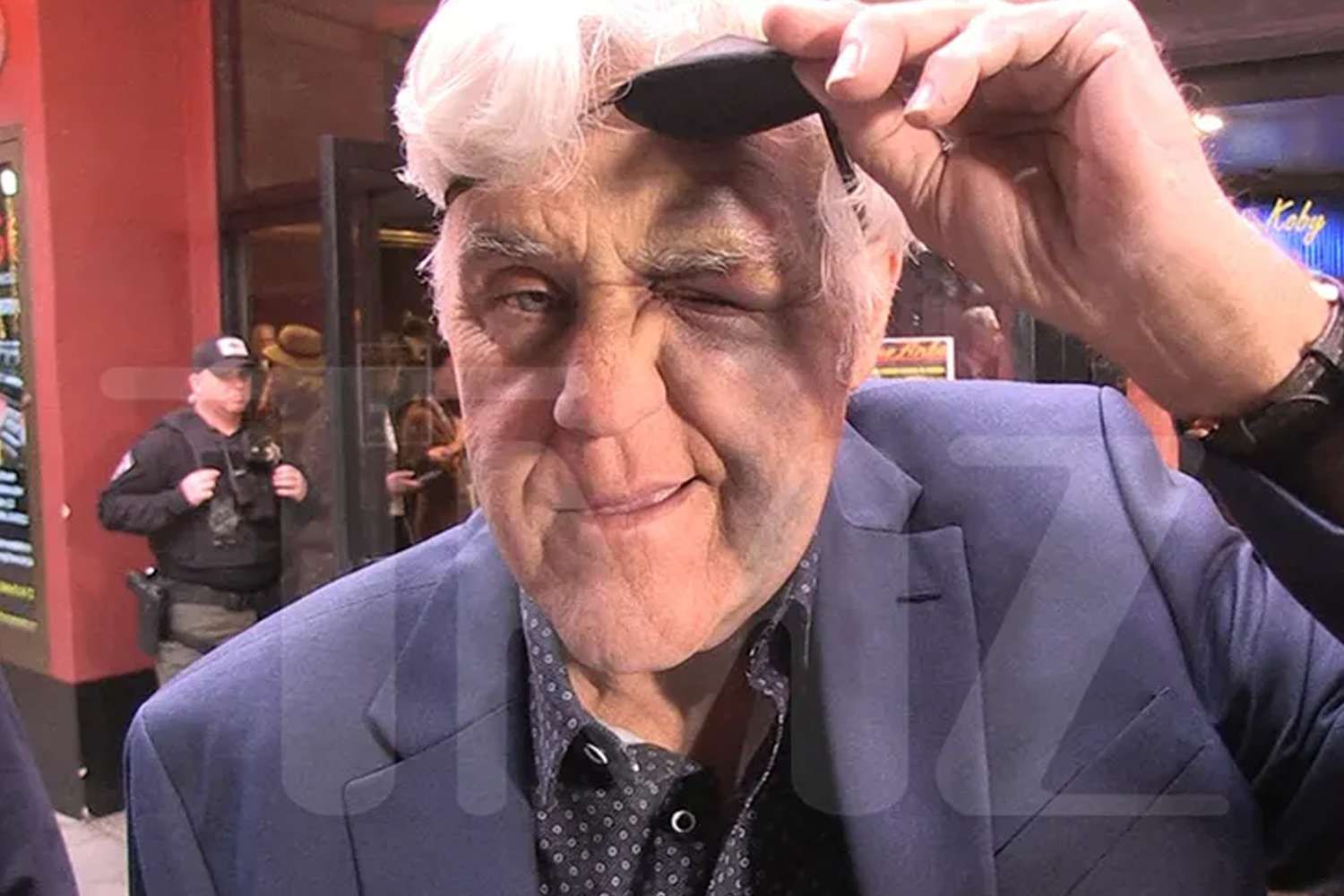 Jay Leno is 'black and blue' and wearing an eye patch after nasty fall