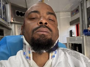 Alleged victim whose head was run over as he tried to hook up seized vehicle to tow truck.