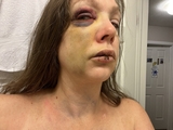 Cincinnati councilwoman under fire for mob attack comments | Toronto Sun