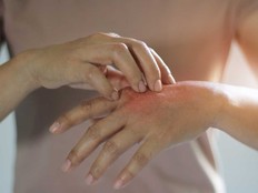 A woman scratches an itch on her hand in this stock photo.