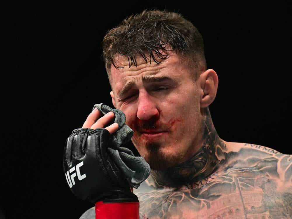 Britain's Tom Aspinall reacts after being punched in the eye during his fight with France's Cyril Gane during their UFC heavyweight title bout at UFC 321 at the Etihad Arena in Abu Dhabi in the early hours of October 26, 2025. 