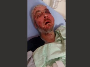 病院にいるニール・コールフィールドの写真。