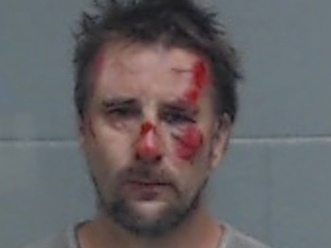 Bloody mugshot shows Florida driver after he jumped from moving car with family inside