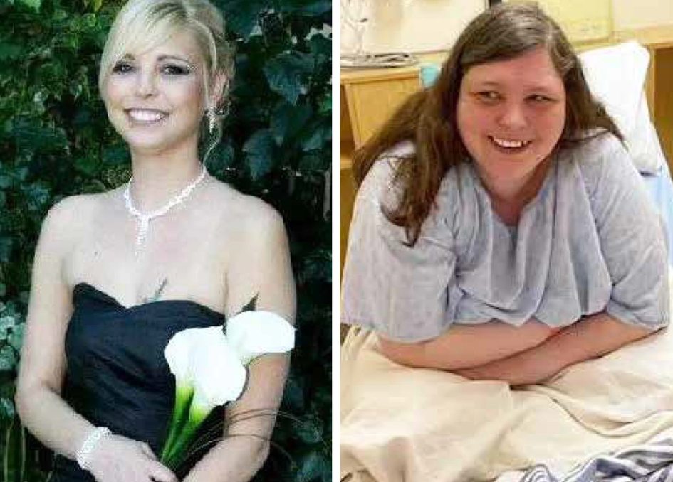 Jolene Van Alstine now hopes to get a life-saving medical operation in Florida instead of turning to medically assisted suicide. Read more.