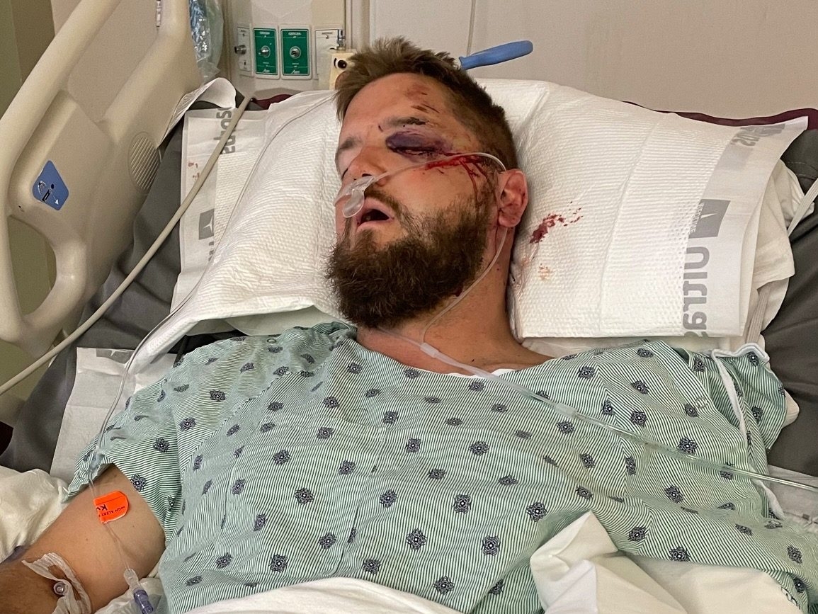  Aric Hutchinson in hospital with serious injuries after drunk driver struck golf cart. (GoFundMe)
