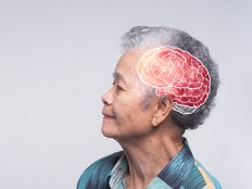 Dementia in senior people. Memory loss. Awareness of Alzheimer's, Parkinson's disease, stroke, seizure, or mental health.