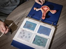 A model of the female reproductive system