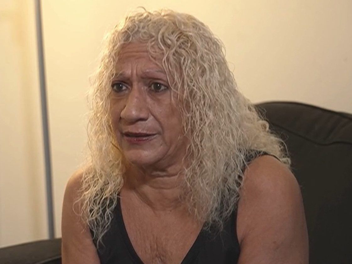 Florida woman sues landlord after losing two toes from spider bites