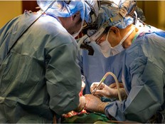 In a 12-hour surgery in May 2023 involving about 15 doctors, nurses and medical staff, lead surgeon Ankit Bharat removed both of the patient's lungs and hooked him up to tubes leading to an artificial lung outside the body. MUST CREDIT: Northwestern Medicine