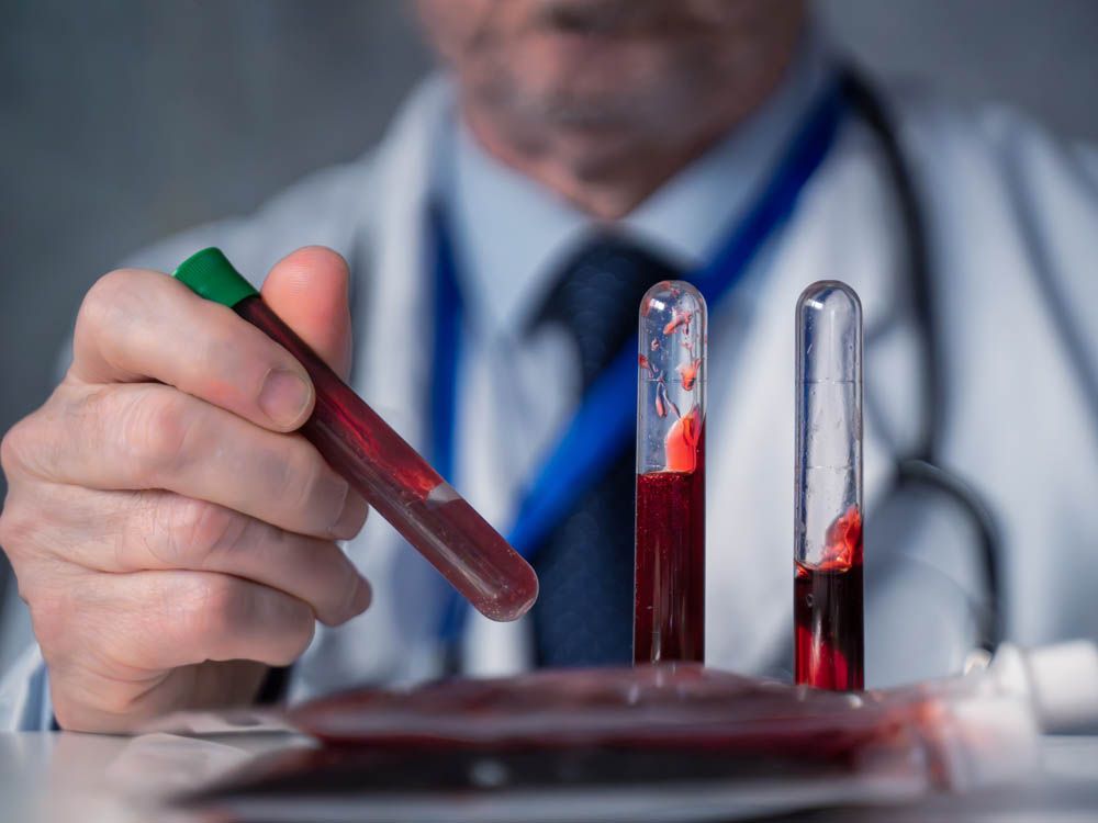 New approach roughly predicts when Alzheimer’s symptoms begin