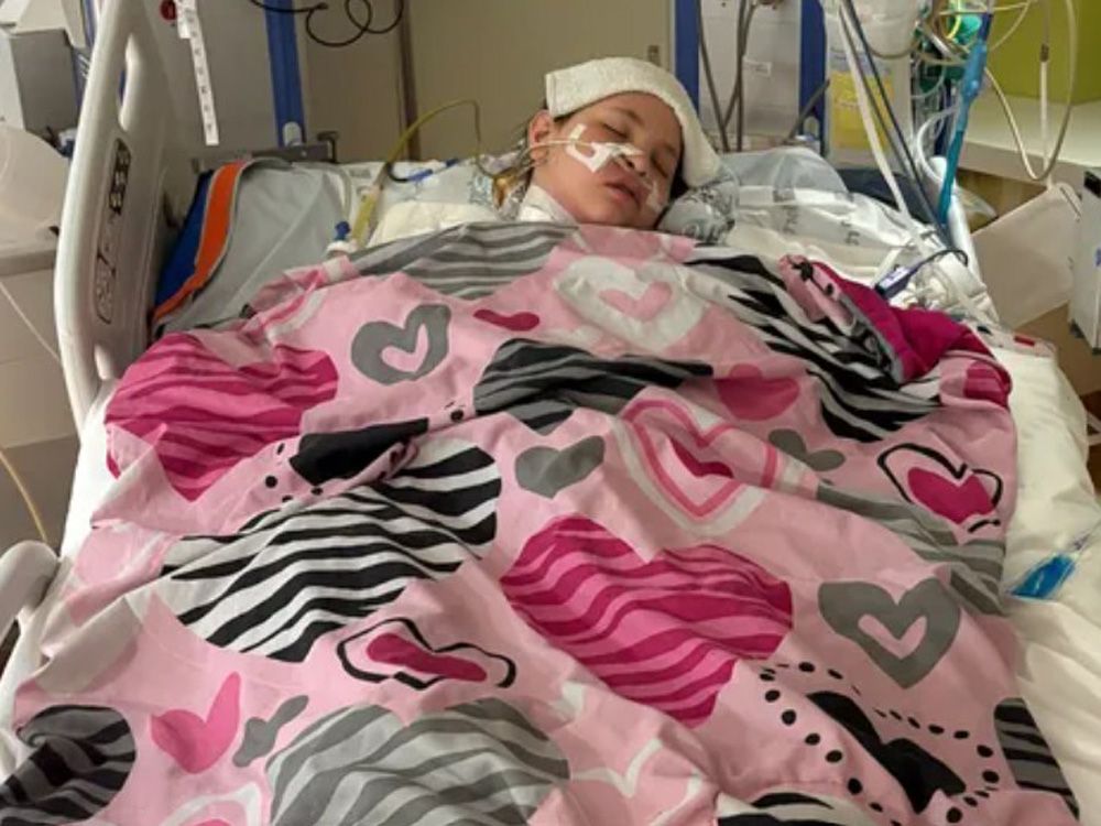 Texas teen loses three of her limbs after flu complications