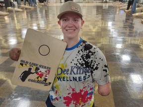 Cornhole player with no arms or legs arrested in shooting Cornhole player with no arms or legs arrested in shooting