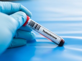 Blood sample tube for testosterone test analysis.