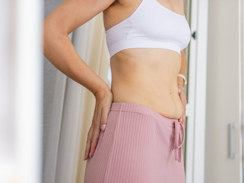 Woman showing loose stomach skin and belly creases after weight loss, reflecting on body changes, stretch mark appearance, and skin health issues related to aging