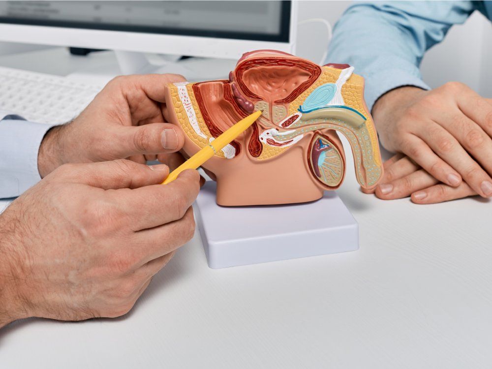 Doctor consulting man patient with suspected prostate cancer using male reproductive system model while visit in urology clinic. Prostate problems and treatment