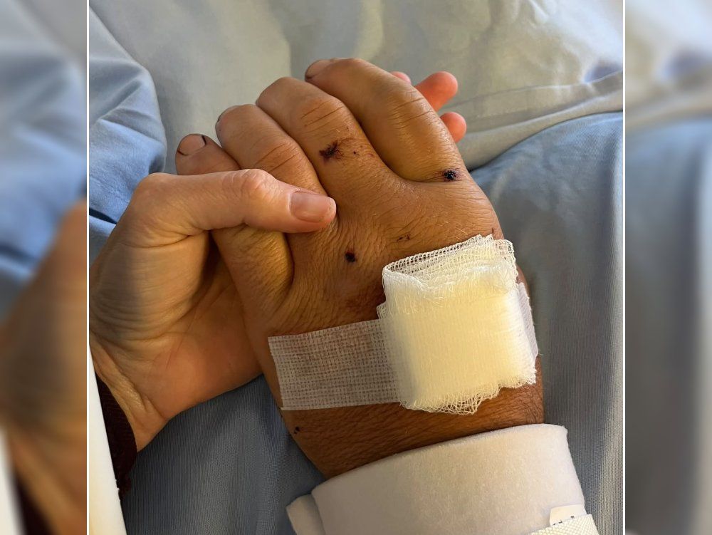 Ashley Smith, the wife of Const. Jeff Smith, shares a photo of his wounded hand alongside a heartfelt message.