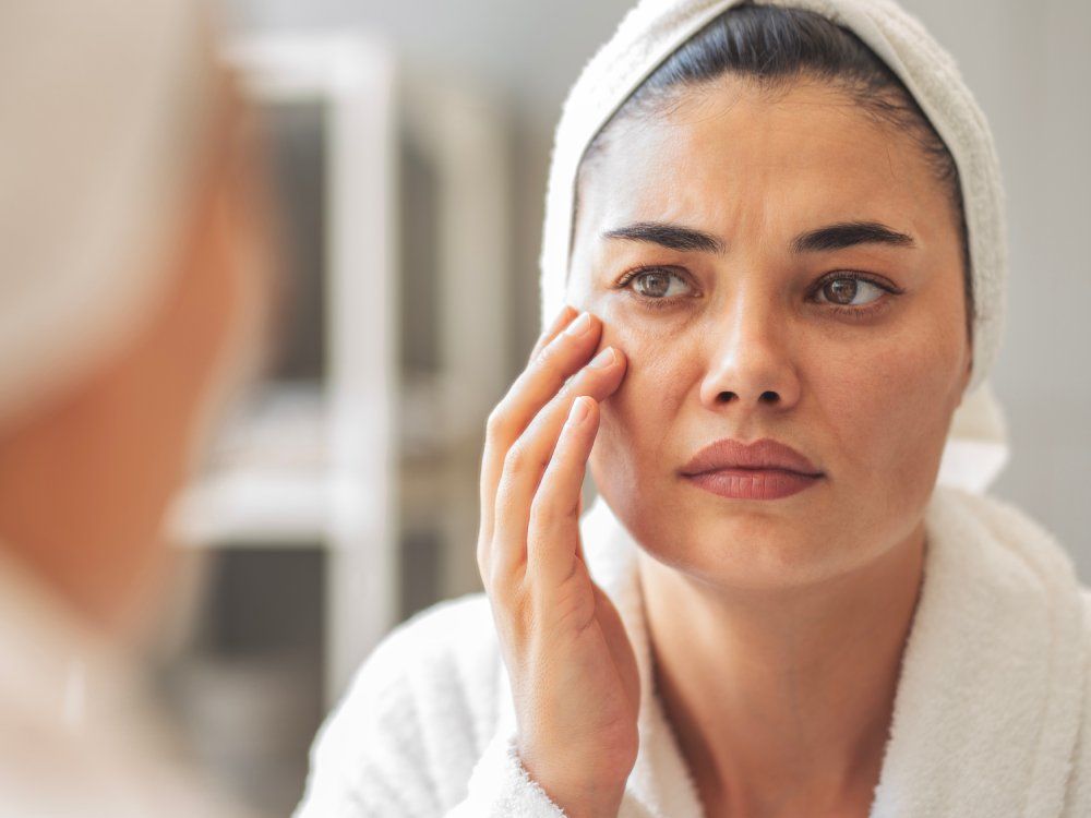 What ‘ferritin face’ means — and how to tell if you may be iron-deficient