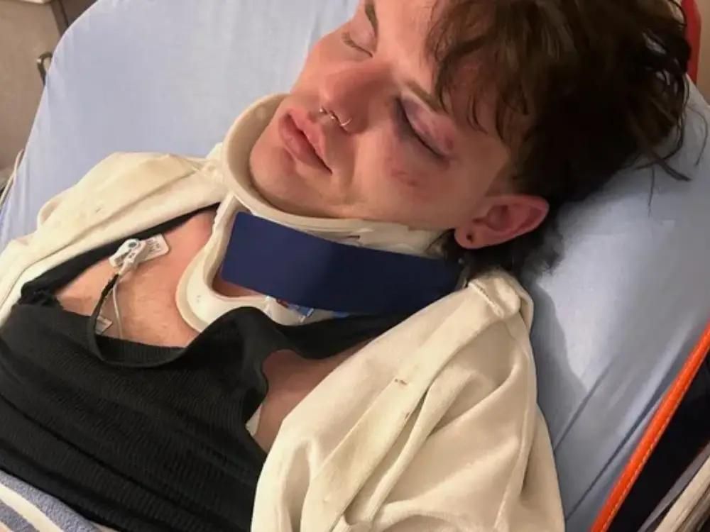 Carson MacDonald, the victim of an assault in downtown St. Catharines on Sept. 26. 