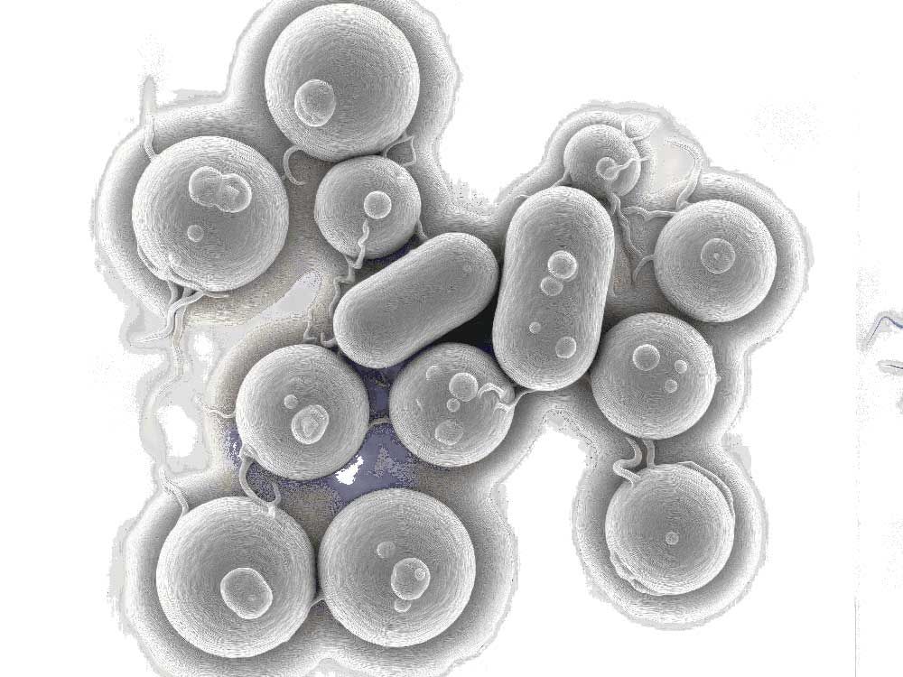 Drug-resistant sexually transmissible bacterial infection rising in U.S: CDC