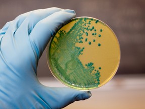 Listeria germs growing on an agar plate.