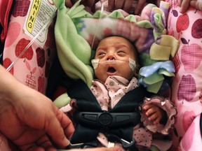 Melinda Star Guido, one of the smallest surviving babies born according to the Global Birth Registry, is pictured as she is discharged from the LAC+USC Medical Center in Los Angeles January 20, 2012. Guido was born on August 30, 2011 at 24 weeks and weighed 9.5 ounces at birth. (REUTERS/Christina House/Los Angeles Times/Pool)