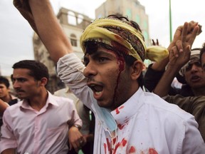 A protester shouts slogans after sustaining injuries from a confrontation with riot police who fired tear gas at them outside the U.S. embassy in Sanaa September 13, 2012. Demonstrators attacked the U.S. embassies in Yemen and Egypt on Thursday in protest at a film they consider blasphemous to Islam, and American warships headed to Libya after the U.S. ambassador there died in related violence earlier this week. (REUTERS/Mohamed al-Sayaghi)