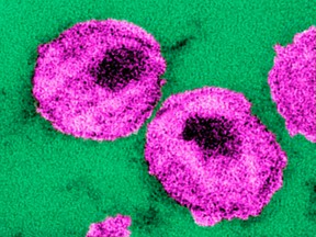 An undated handout image provided by the Centers for Disease Control and Prevention shows the ultra-structural details of a number of Human Immunodeficiency Virus (HIV) particles. REUTERS FILE PHOTO