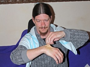 Jay McKillen demonstrates the strangely stretchy condition of his skin, a common symptom of Ehlers Danlos syndrome. McKillen has yet to be diagnosed as having EDS, though he says it is difficult to diagnose due to a lack of education about the disease and the long list of symptoms associated with it, almost all of which are symptoms of other conditions and diseases. (Tori Stafford The Whig-Standard)