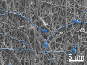 The electrospun fibers can release chemicals or physically block sperm. (University of Washington)