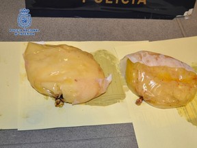 Breast implants stuffed with cocaine are seen in this handout picture released by Spain's Police December 12, 2012. (REUTERS/Spanish Interior Ministry/Handout)