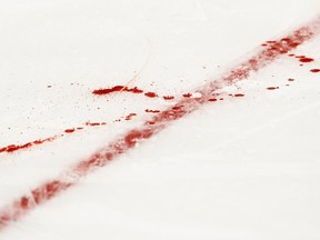 Officials are probing allegations that a minor hockey coach told his team of teenaged boys how to fight on the ice. One player might have suffered a concussion as a result. (Note: This is not a picture involving any of the alleged incidents involving minors.)(REUTERS)