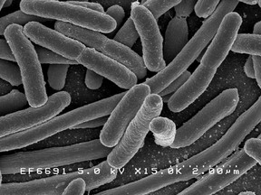 E. coli bacteria