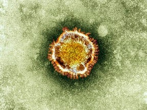 A SARS coronavirus is seen in this undated handout photograph released in London September 28, 2012.