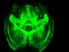 A CLARITY scan of an entire intact mouse brain is seen in this undated handout image courtesy of Kwanghun Chung and Karl Deisseroth, of Howard Hughes Medical Institute at Stanford University.  A method has been developed to replace the opaque tissue in brains with a clear "hydrogel" resulting in transparent mouse and human brains with details invisible to the most sophisticated current techniques, without destroying the brains' 3-D structure or the integrity of their neural circuits. REUTERS/Kwanghun Chung and Karl Deisseroth, Howard Hughes Medical Institute/Stanford University/Handout