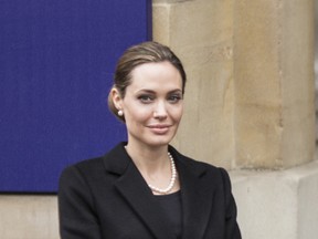 Actress Angelina Jolie underwent a secret double mastectomy earlier this year. (WENN.COM)