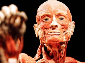 The new Body Worlds & The Cycle of Life exhibit is up and running at the Telus World of Science. FILE PHOTO