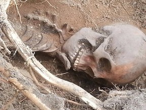 The bones of an Aboriginal woman, pictured here June 4, were unearthed in a Point Edward backyard. Homeowners uncovered these bones while constructing a new fence. SUBMITTED PHOTO/THE OBSERVER/QMI AGENCY