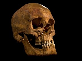 What is believed to be the skull of King Richard III, who was killed at the Battle of Bosworth in 1485. His body was discovered during an archeological dig beneath a parking lot in Leicester, England, last year.