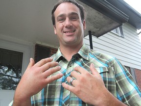 Mayor Mark Gerretsen shows his right hand, still swollen from multiple stings over the weekend. (Michael Lea The Whig-Standard)