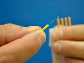 A closer look at some acupuncture needles.
SUBMITTED