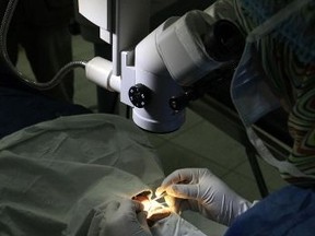 cataract surgery