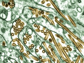 This photograph from a colorized transmission electron micrograph of Avian influenza A H5N1 viruses (seen in gold) which have been grown in MDCK cells (seen in green) is shown in this undated photograph from the the United States government's Centers for Disease Control.