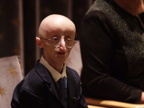 Sam Berns attends The New York Premiere Of HBO's "Life According To Sam" at HBO Theater on October 8, 2013 in New York City. (Thos Robinson/Getty Images for HBO/AFP)